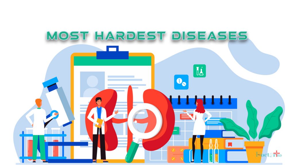 6 Most Hardest Diseases To Diagnose
