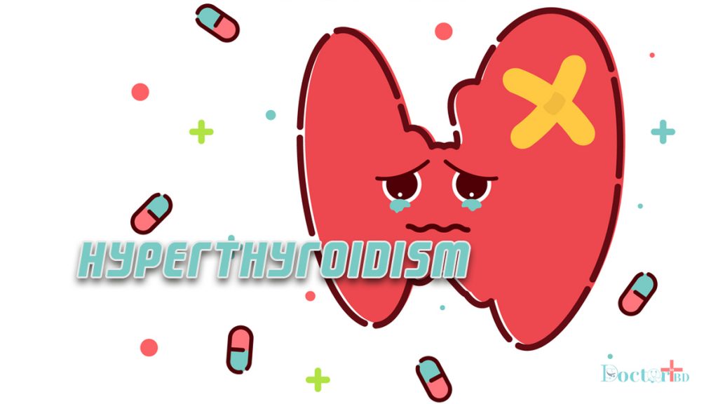 Hyperthyroidism Disease Discussion