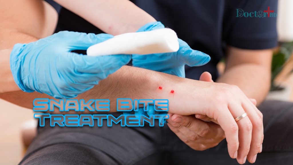 Snake Bite Treatment Protocol: Treating In A Professional Way ...