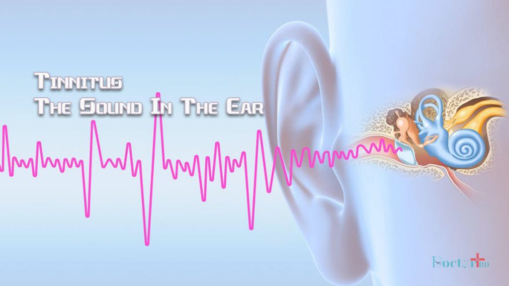 Tinnitus: The Sound in the Ear – Types and Causes